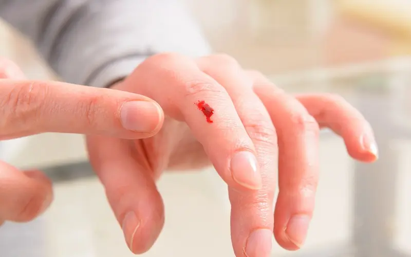 Giải mã “mơ thấy máu điềm là tốt hay xấu?” Giải mã “mơ thấy máu điềm là tốt hay xấu?”